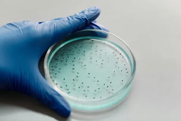 Petrischaaltje met blauwe vloeistof en bacterien. Wordt vastgehouden door een hand met een blauwe latex handschoen aan.