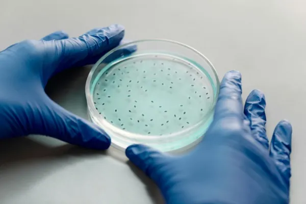 Petrischaaltje met blauwe vloeistof en bacterien. Wordt vastgehouden door een hand met een blauwe latex handschoen aan.